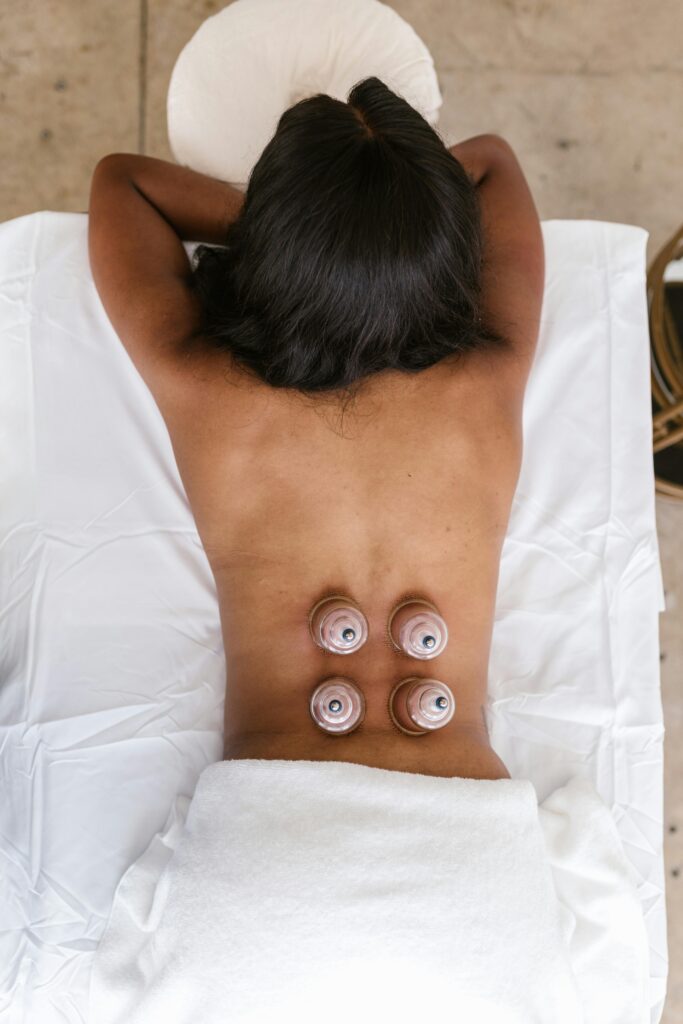 pexels-photo-8313250-8313250 Back view of a woman receiving cupping therapy in a spa, promoting wellness and relaxation.